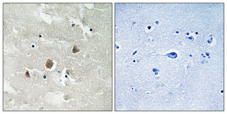 Immunohistochemical analysis of paraffin-embedded human brain tissue using MAP3K1 (Phospho-Thr1400) antibody (left)or the same antibody preincubated with blocking peptide (right).