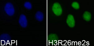 Immunofluorescence analysis of 293T cell using H3R26me2s antibody. Blue: DAPI for nuclear staining.