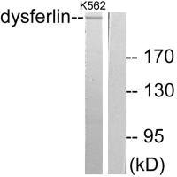 Western blot analysis of extracts from K562 cells, using Dysferlin antibody.