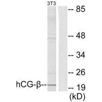 Western blot analysis of extracts from NIH/3T3 cells, using hCG beta antibody.