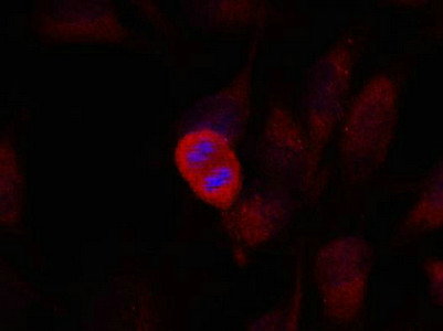 Immunofluorescence staining of methanol-fixed Hela cells using SEK1/MKK4(Ab-261) Antibody.