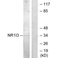 Western blot analysis of extracts from Jurkat cells, treated with serum (20%, 15mins), using NR1I3 antibody.