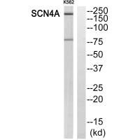 Western blot analysis of extracts from K562 cells, using SCN4A antibody.