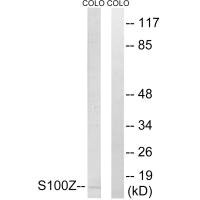 Western blot analysis of extracts from COLO cells, using S100Z antibody.