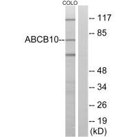 Western blot analysis of extracts from COLO cells, using ABCB10 antibody.