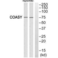 Western blot analysis of extracts from HepG2 cells and K562 cells, using GA45G antiobdy.