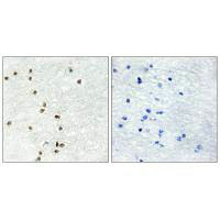 Immunohistochemistry analysis of paraffin-embedded human brain tissue using ZIC1/2/3 antibody.