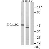 Western blot analysis of extracts from Jurkat cells and COLO cells, using ZIC1/2/3 antibody.