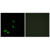 Immunofluorescence analysis of HeLa cells, using HMG17 antibody.