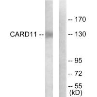 Western blot analysis of extracts from COLO205 cells, using CARD11 antibody.