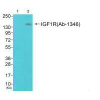 Western blot analysis of extracts from 293 cells (Lane 2), using IGF1R (Ab-1346) antiobdy. The lane on the left is treated with synthesized peptide.