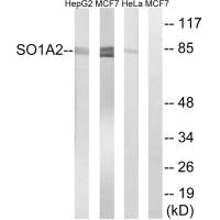 Western blot analysis of extracts from HepG2 cells, MCF-7 cells and HeLa cells, using SLCO1A2 antibody.