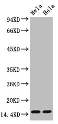 Western blot analysis of Hela, diluted at 1) 1:1000 2) 1:5000