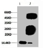 Western blot analysis of Hela, diluted at 1:500.