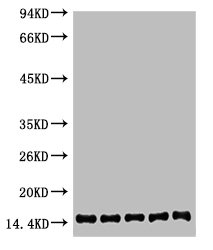 Western blot analysis of 1) Hela, 2) 3T3, 3) Raw264.7, 4) Rat Brain, 5) Rat Kidney, diluted at 1:2000.