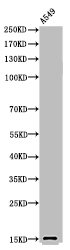 Western Blot analysis of A549 cells using Acetyl-Histone H2B (K126) Polyclonal Antibody