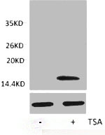 Western blot analysis of extracts from Hela cells, untreated (-) or treated, 1:2000.