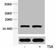 Western blot analysis of extracts from Hela cells, untreated (-) or treated, 1:2000.