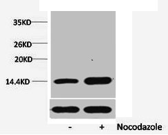 Western blot analysis of extracts from Hela cells, untreated (-) or treated, 1:5000.