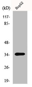 anti-Homo sapiens (Human) LGALS9 Antibody raised in Rabbit - Cusabio