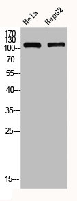 Western Blot analysis of HELA HEPG2 using GluR-1 Polyclonal Antibody