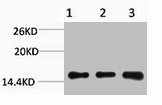 Western blot analysis of 1) Hela, 2) 3T3, 3) Rat Liver Tissue, diluted at 1:1000.