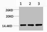 Western blot analysis of 1) Hela, 2) 3T3, 3) Rat Liver Tissue, diluted at 1:1000.