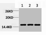 Western blot analysis of 1) Hela, 2) 3T3, 3) Rat Liver Tissue, diluted at 1:1000.