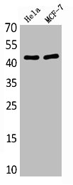 Western Blot analysis of various cells using Antibody diluted at 1:1000. Secondary antibody was diluted at 1:20000