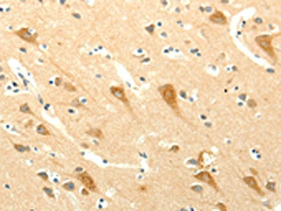 The image on the left is immunohistochemistry of paraffin-embedded Human brain tissue using CSB-PA074430(SYT5 Antibody) at dilution 1/15, on the right is treated with fusion protein. (Original magnification: x200)