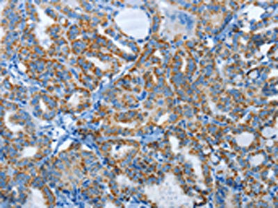 anti Homo sapiens Human AGL Antibody raised in Rabbit Cusabio