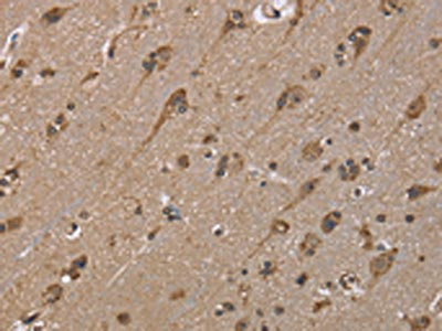 The image is immunohistochemistry of paraffin-embedded Human brain tissue using CSB-PA526376(GADD45B Antibody) at dilution 1/40. (Original magnification: x200)