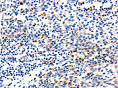 The image on the left is immunohistochemistry of paraffin-embedded Human tonsil tissue using CSB-PA620207(GADD45G Antibody) at dilution 1/120, on the right is treated with fusion protein. (Original magnification: x200)