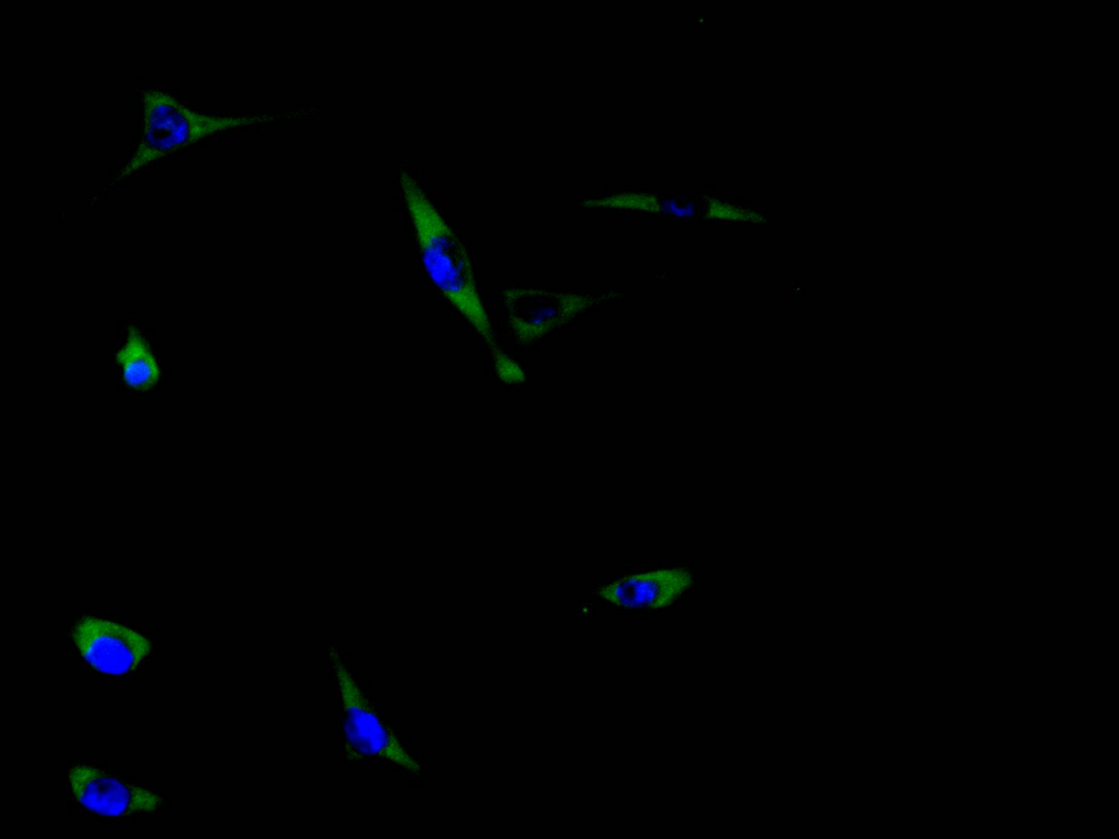 Immunofluorescence staining of MCF-7 cell with CSB-PA827811 at 1:30, counter-stained with DAPI. The cells were fixed in 4% formaldehyde and blocked in 10% normal Goat Serum. The cells were then incubated with the antibody overnight at 4C. The secondary antibody was Alexa Fluor 488-congugated AffiniPure Goat Anti-Rabbit IgG(H+L).