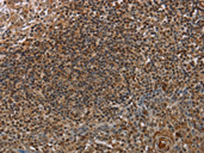 The image on the left is immunohistochemistry of paraffin-embedded Human tonsil tissue using CSB-PA850358(MARK1 Antibody) at dilution 1/40, on the right is treated with synthetic peptide. (Original magnification: x200)