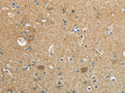 The image on the left is immunohistochemistry of paraffin-embedded Human brain tissue using CSB-PA938031(WISP1 Antibody) at dilution 1/25, on the right is treated with synthetic peptide. (Original magnification: x200)