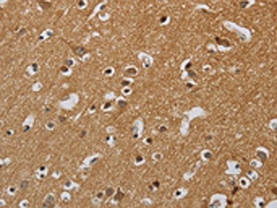 The image on the left is immunohistochemistry of paraffin-embedded Human brain tissue using CSB-PA950042(KIF4A Antibody) at dilution 1/40, on the right is treated with synthetic peptide. (Original magnification: x200)