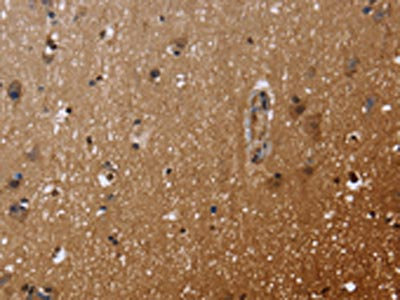 The image on the left is immunohistochemistry of paraffin-embedded Human brain tissue using CSB-PA977533(FHL3 Antibody) at dilution 1/40. (Original magnification: x200)