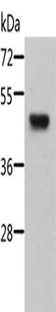 Gel: 10%SDS-PAGE, Lysate: 40 ug, Lane: Mouse pancreas tissue, Primary antibody: CSB-PA052910(STRADB Antibody) at dilution 1/500, Secondary antibody: Goat anti rabbit IgG at 1/8000 dilution, Exposure time: 10 minutes