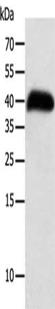 Gel: 10%SDS-PAGE, Lysate: 40 ug, Lane: Human thigh malignant fibrous histiocytoma tissue, Primary antibody: CSB-PA074430(SYT5 Antibody) at dilution 1/100, Secondary antibody: Goat anti rabbit IgG at 1/8000 dilution, Exposure time: 8 hours