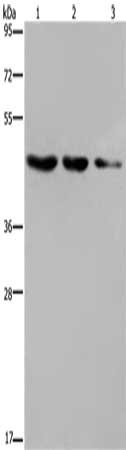 Gel: 8%SDS-PAGE, Lysate: 40 ug, Lane 1-3: Raji cells, human fetal brain tissue, mouse brain tissue, Primary antibody: CSB-PA223936(ELOVL6 Antibody) at dilution 1/400, Secondary antibody: Goat anti rabbit IgG at 1/8000 dilution, Exposure time: 30 seconds