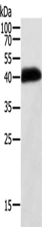 Gel: 10%SDS-PAGE, Lysate: 40 ug, Lane: Human thigh malignant fibrous histiocytoma tissue, Primary antibody: CSB-PA447958(SYT5 Antibody) at dilution 1/150, Secondary antibody: Goat anti rabbit IgG at 1/8000 dilution, Exposure time: 8 hours