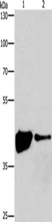 Gel: 8%SDS-PAGE, Lysate: 40 ug, Lane 1-2: 293T cells, human fetal brain tissue, Primary antibody: CSB-PA657855(MAPK11 Antibody) at dilution 1/200, Secondary antibody: Goat anti rabbit IgG at 1/8000 dilution, Exposure time: 30 seconds