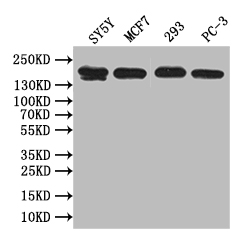 Western Blot Positive WB detected in: SY5Y whole cell lysate, MCF7 whole cell lysate, 293 whole cell lysate, PC-3 whole cell lysate All lanes: ABCA3 antibody at 1:1000 Secondary Goat polyclonal to rabbit IgG at 1/50000 dilution Predicted band size: 192 kDa Observed band size: 192 kDa