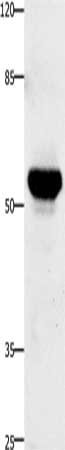 Gel: 10%SDS-PAGE, Lysate: 30 ug, Lane: Human fetal brain tissue, Primary antibody: CSB-PA907764(TNFRSF21 Antibody) at dilution 1/420, Secondary antibody: Goat anti rabbit IgG at 1/8000 dilution, Exposure time: 30 seconds