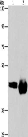 Gel: 6%SDS-PAGE, Lysate: 40 microg, Lane 1-2: A549 cells, Raji cells, Primary antibody: CSB-PA926996(CD38 Antibody) at dilution 1/520, Secondary antibody: Goat anti rabbit IgG at 1/8000 dilution, Exposure time: 3 minutes