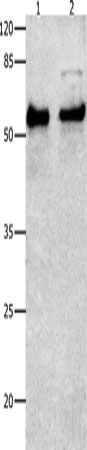 Gel: 10%SDS-PAGE, Lysate: 30 ug, Lane 1-2: Human liver cancer tissue, Hela cells, Primary antibody: CSB-PA948107(SMAD4 Antibody) at dilution 1/150, Secondary antibody: Goat anti rabbit IgG at 1/8000 dilution, Exposure time: 2 minutes