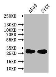 Western Blot Positive WB detected in: A549 whole cell lysate, SY5Y whole cell lysate All lanes: CXCL16 antibody at 1:1000 Secondary Goat polyclonal to rabbit IgG at 1/50000 dilution Predicted band size: 28 kDa Observed band size: 28 kDa