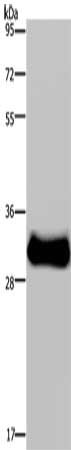 Gel: 8%SDS-PAGE, Lysate: 40 microg, Lane: Mouse skeletal muscle tissue, Primary antibody: CSB-PA977533(FHL3 Antibody) at dilution 1/1600, Secondary antibody: Goat anti rabbit IgG at 1/8000 dilution, Exposure time: 30 seconds