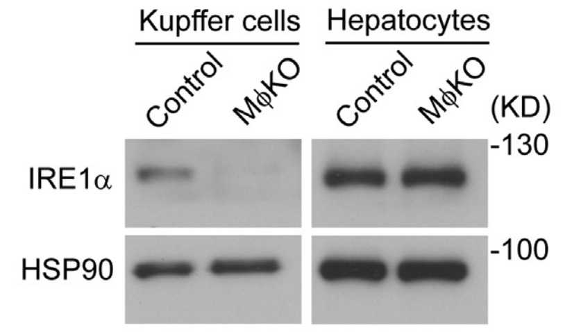 Recombinant ERN1 Antibody (Clone No.: 1F12; Phospho: S724)- CUSABIO